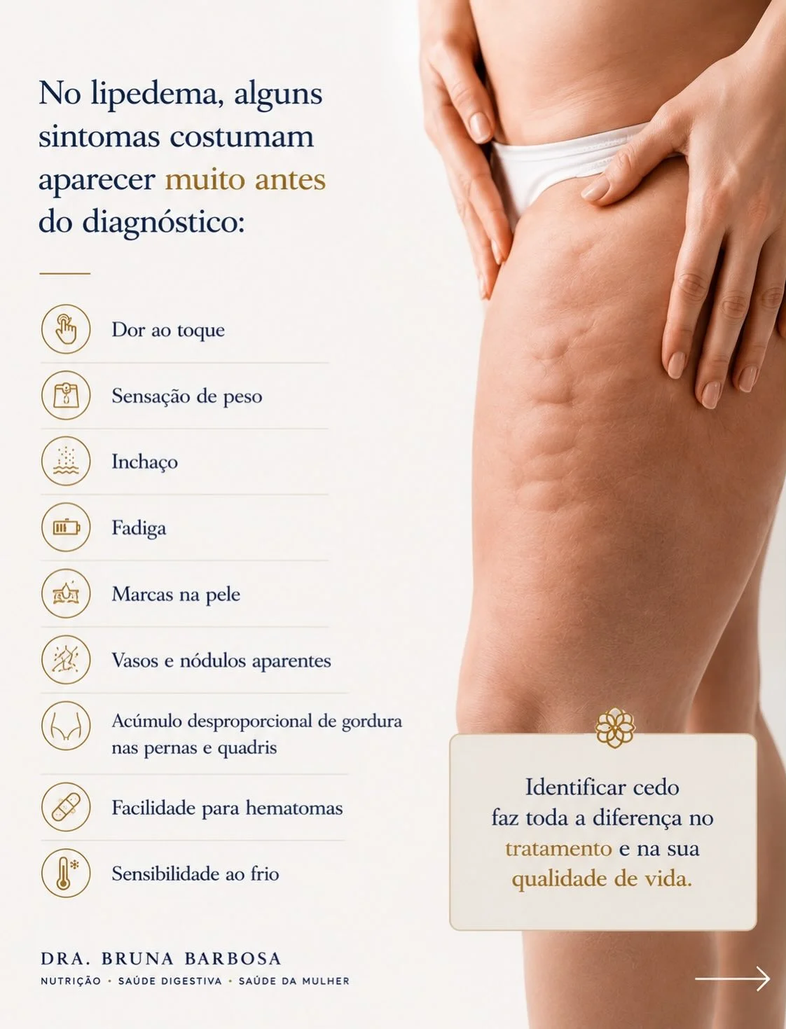 9 sinais precoces do lipedema: dor ao toque, peso, inchaço, fadiga, marcas na pele, vasos aparentes, gordura desproporcional, hematomas fáceis, frio