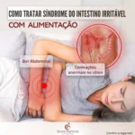 Dicas de alimentação para tratar a síndrome do intestino irritável e aliviar sintomas.