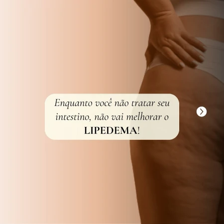 Lipedema e saúde intestinal: Trate seu intestino para melhorar sua saúde e aparência corporal.